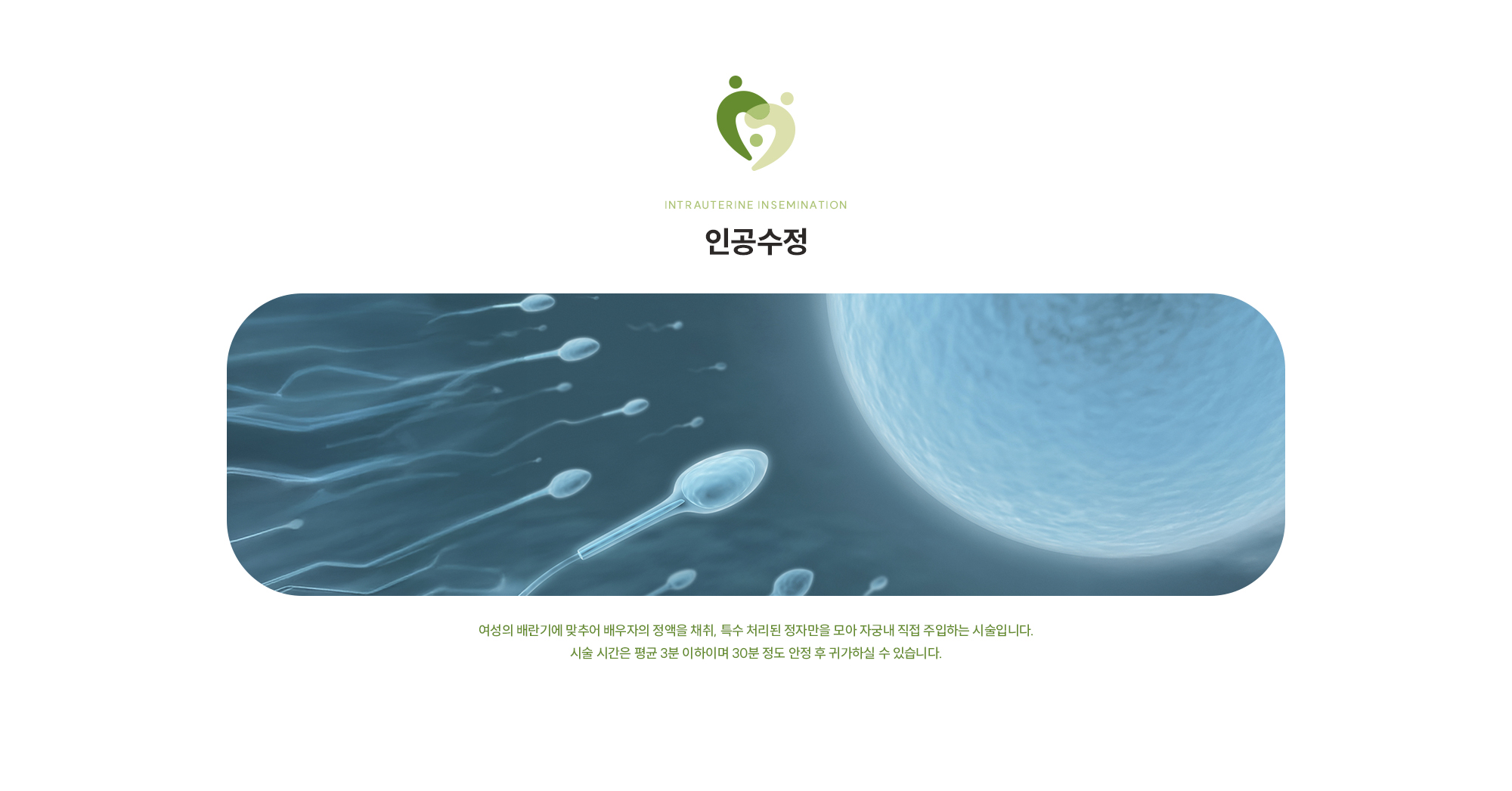 [인공수정] 여성의 배란기에 맞추어 배우자의 정액을 채취, 특수 처리된 정자만을 모아 자궁내 직접 주입하는 시술입니다. 시술 시간은 평균 3분 이하이며 30분 정도 안정 후 귀가하실 수 있습니다.