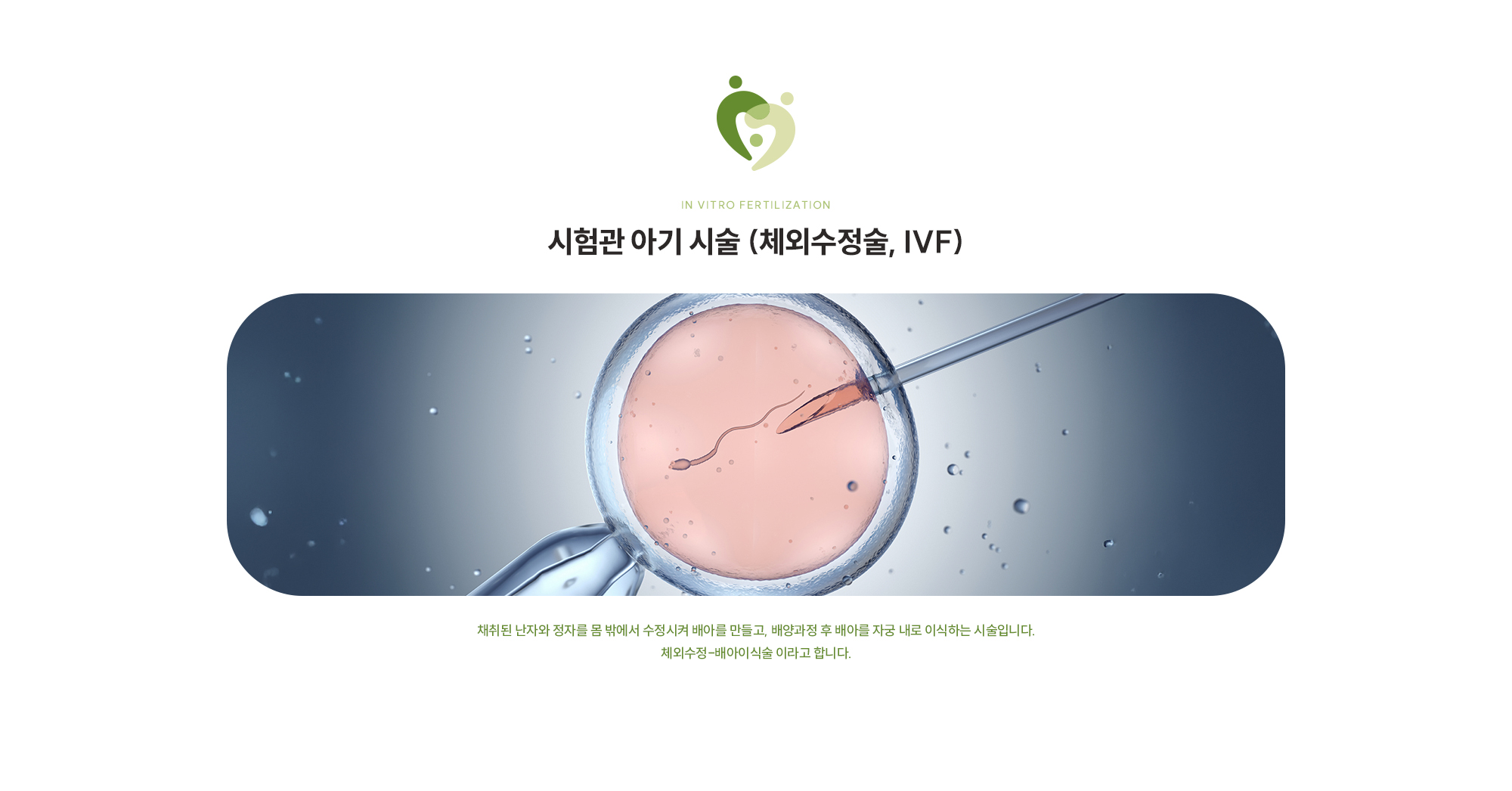 [시험관 아기 시술 (체외수정술, IVF)] 채취된 난자와 정자를 몸 밖에서 수정시켜 배아를 만들고, 배양과정 후 배아를 자궁 내로 이식하는 시술입니다. 체외수정-배아이식술 이라고 합니다.