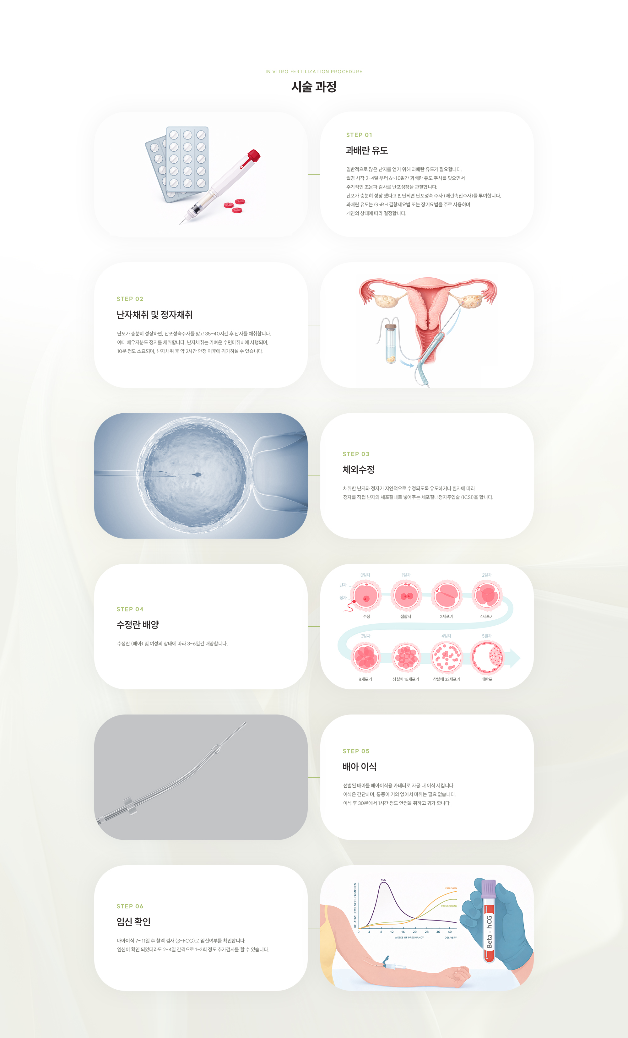 [시술 과정] {STEP 01} 과배란 유도 : 월경 시작 2-4일부터 6~10일간 과배란 유도 주사를 맞으면서 주기적인 초음파 검사로 난포성장을 관찰하여 난포가 충분히 성장 했다고 판단되면 난포성숙 주사 (배란촉진주사)를 투여합니다. {STEP 02} 난자채취 및 정자채취 : 난포가 충분히 성장하면, 난포성숙주사를 맞고 35-40시간 후 난자와 배우자의 정자를 채취합니다. 난자채취는 가벼운 수면마취하에 시행되며, 10분 정도 소요되며, 난자채취 후 약 2시간 안정 이후에 귀가하실 수 있습니다. {STEP 03} 체외수정 : 채취한 난자와 정자가 자연적으로 수정되도록 유도하거나 환자에 따라 정자를 직접 난자의 세포질내로 넣어주는 세포질내정자주입술 (ICSI)을 합니다. {STEP 04} 수정란 배양 : 수정란 (배아) 및 여성의 상태에 따라 3-6일간 배양합니다. {STEP 05} 배아 이식 : 선별된 배아를 배아이식용 카테터로 자궁 내 이식 시킵니다. 이식은 간단하며, 통증이 거의 없어서 마취는 필요 없습니다. 이식 후 30분에서 1시간 정도 안정을 취하고 귀가 합니다. {STEP 06} 임신 확인 : 배아이식 7~11일 후 혈액 검사 (β-hCG)로 임신여부를 확인합니다. 임신이 확인 되었더라도 2-4일 간격으로 1-2회 정도 추가검사를 할 수 있습니다.