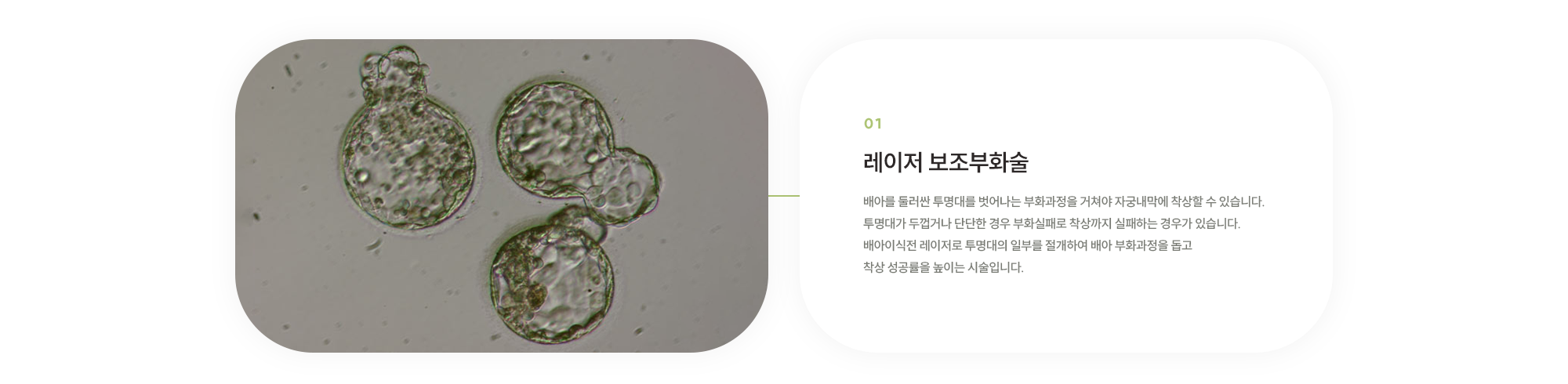 레이저 보조부화술 : 배아를 둘러싼 투명대를 벗어나는 부화과정을 거쳐야 자궁내막에 착상할 수 있습니다. 투명대가 두껍거나 단단한 경우 부화실패로 착상까지 실패하는 경우가 있습니다. 배아이식전 레이저로 투명대의 일부를 절개하여 배아 부화과정을 돕고 착상 성공률을 높이는 시술입니다.