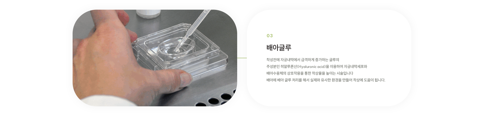 배아글루 : 착성전에 자궁내막에서 급격하게 증가하는 글루의 주성분인 히알루론산(Hyaluronic acid)을 이용하여 자궁내막세포와 배아수용체의 상호작용을 통한 착상율을 높이는 시술입니다 배아에 베아 글루 처리를 해서 실제와 유사한 환경을 만들어 착상에 도움이 됩니다.