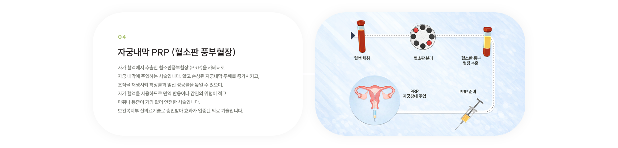 자궁내막 PRP (혈소판 풍부혈장) : 자가 혈액에서 추출한 혈소판풍부혈장 (PRP)을 카테터로 자궁 내막에 주입하는 시술입니다. 얇고 손상된 자궁내막 두께를 증가시키고, 조직을 재생시켜 착상률과 임신 성공률을 높일 수 있으며, 자가 혈액을 사용하므로 면역 반응이나 감염의 위험이 적고 마취나 통증이 거의 없어 안전한 시술입니다. 보건복지부 신의료기술로 승인받아 효과가 입증된 의료 기술입니다.