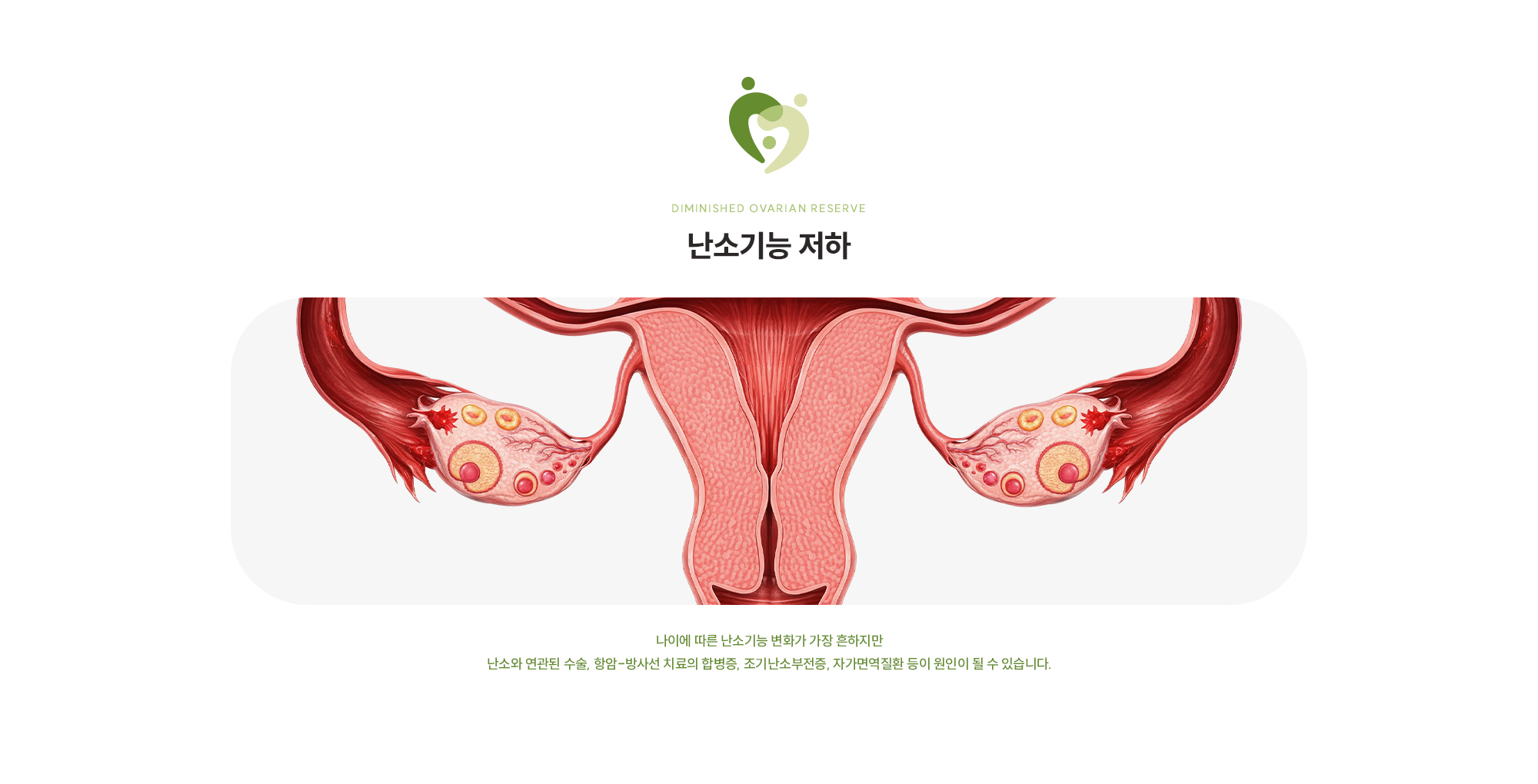 [난소기능 저하] 나이에 따른 난소기능 변화가 가장 흔하지만 난소와 연관된 수술, 항암-방사선 치료의 합병증, 조기난소부전증, 자가면역질환 등이 원인이 될 수 있습니다.