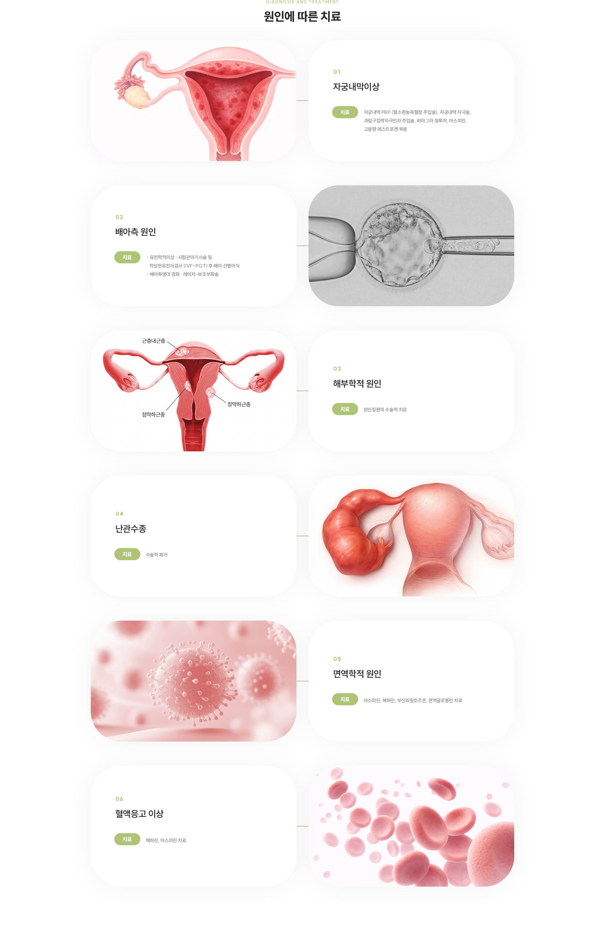 [원인에 따른 치료] 자궁내막이상 : 자궁내막 PRP (혈소판농축혈장 주입술), 자궁내막 자극술, 과립구집락자극인자 주입술, 비아그라 질투여, 아스피린, 고용량 에스트로겐 복용 / 배아측 원인 : · 유전학적이상 : 시험관아기시술 및 착상전유전자검사 (IVF-PGT) 후 배아 선별이식 · 배아투명대 경화 : 레이저-보조부화술 / 해부학적 원인 : 원인질환의 수술적 치료 / 난관수종 : 수술적 제거 / 면역학적 원인 : 아스피린, 헤파린, 부신피질호르몬, 면역글로블린 치료 / 혈액응고 이상 : 헤파린, 아스피린 치료